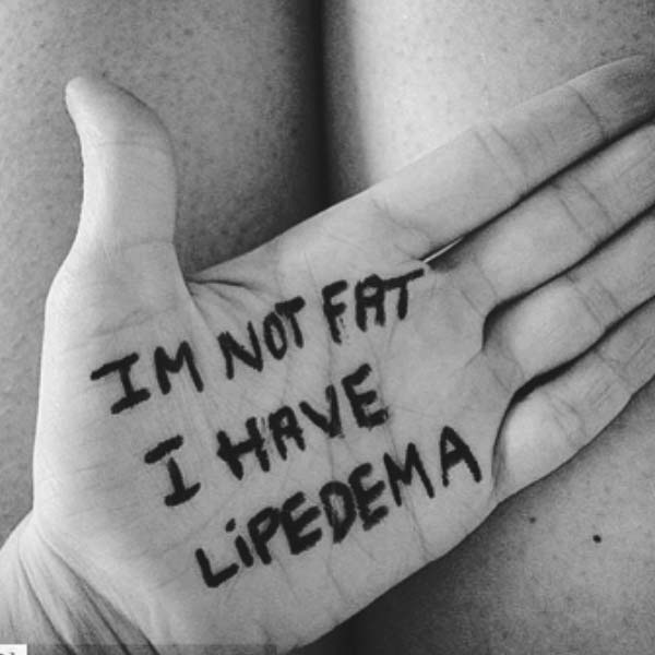 im not fat, i have lipedema