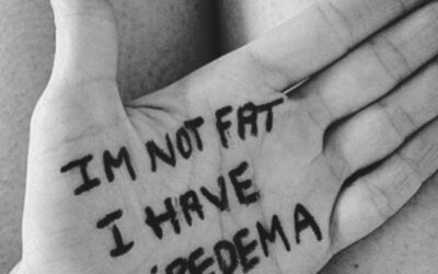 9 Cosas que has de saber sobre el Lipedema