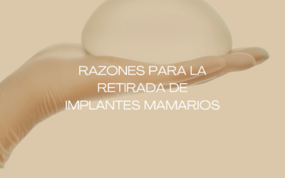 Extracción de prótesis mamarias en Barcelona