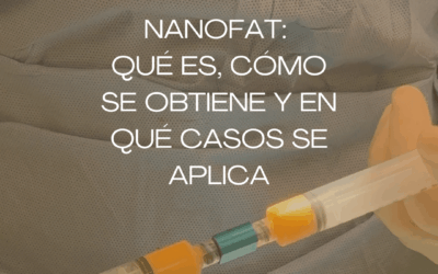 Nanofat en Barcelona: qué es, cómo se obtiene y en qué casos se aplica