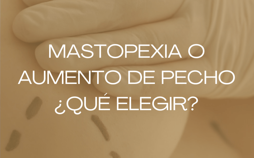 Mastopexia o aumento de pecho en Barcelona: Cómo saber qué cirugía necesitas realmente